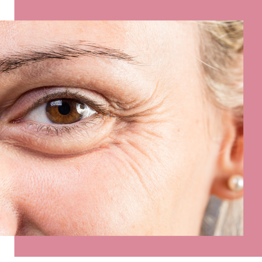 women with wrinkles around eye